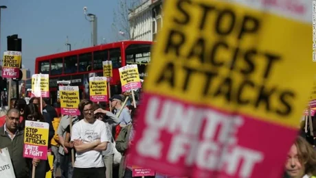 Reino Unido: niños se “blanquean” la piel para evitar abusos racistas