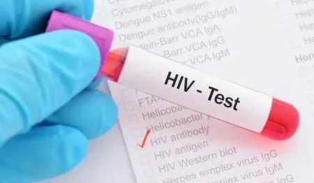 Descubren un nuevo subtipo de VIH después de casi 20 años