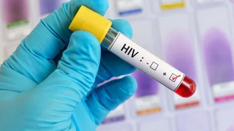 Una mujer argentina logró "controlar" el VIH y su caso es único en el mundo