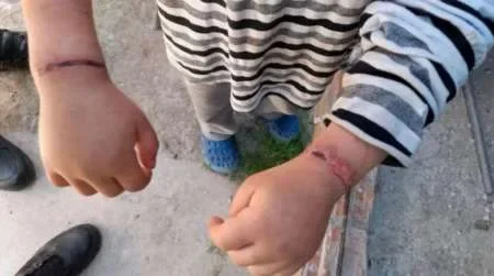 Maltrato infantil: rescatan a dos niños que fueron atados con alambres por su madre y padrastro