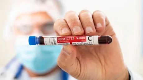 Detectan un caso de hepatitis en Argentina con un "origen desconocido"