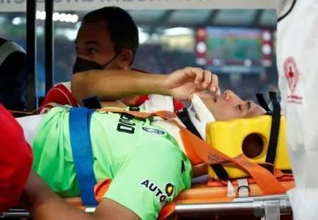 Juan Musso fue operado por una fractura de pómulo y complica sus chances para ir al mundial