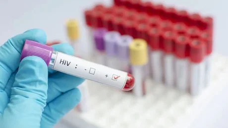 Preocupación: Salta tiene la segunda tasa de transmisión del VIH a nivel país