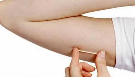 Colocarán de manera gratuita implantes subdérmicos anticonceptivos en Salta: dan solo 50 turnos