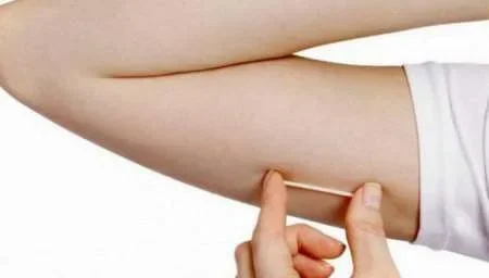 Ya se otorgan turnos para la colocación de implantes anticonceptivos gratis en Salta