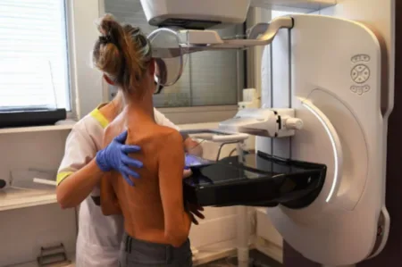 Mamografías gratuitas: mirá donde se realizan